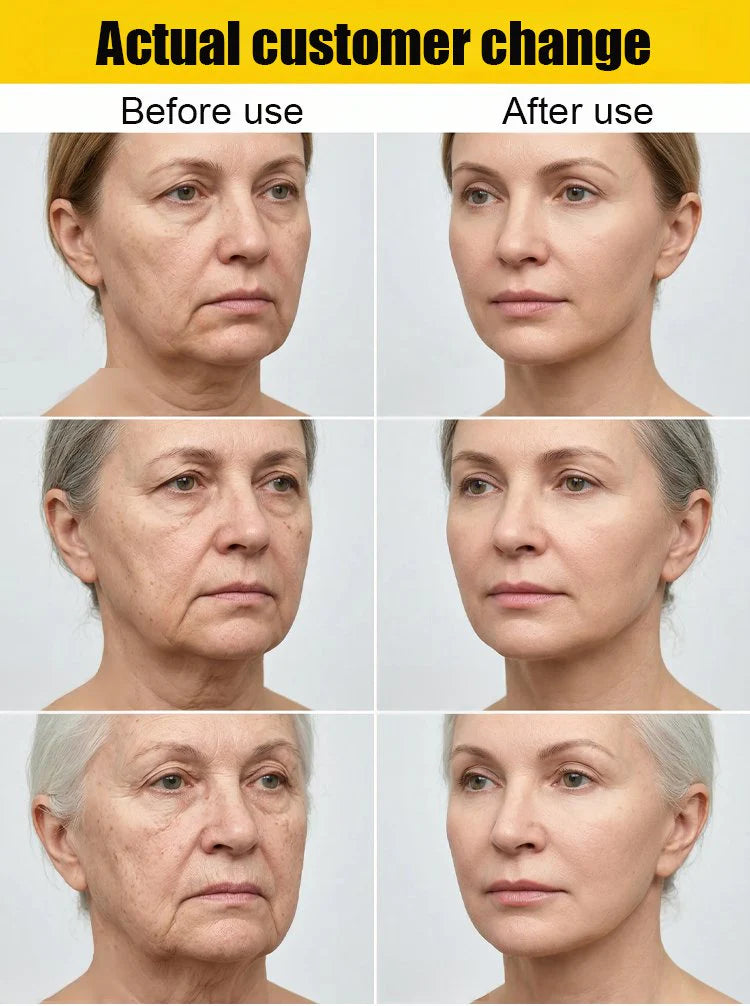 Avasoma® 🏆Flash Sale⚡OEOMON™ Collagen Fullerene Neck Cream – Elevate Your Neck Care Routine ✨