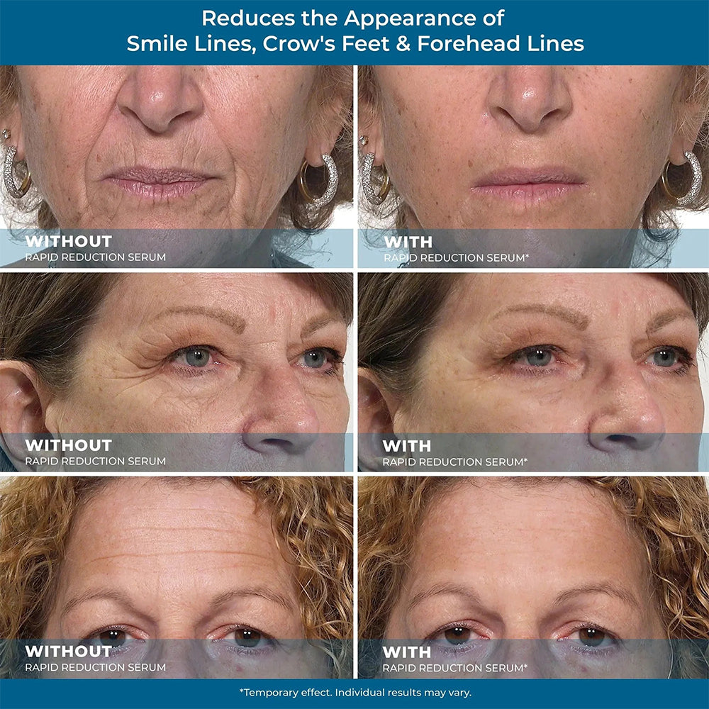 Avasoma® Rapid Reduction Eye Serum - Anti Aging Wrinkle Remover for Face, Scientific formula for easy absorption without greasiness