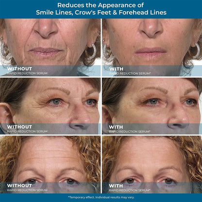 Avasoma® Rapid Reduction Eye Serum - Anti Aging Wrinkle Remover for Face, Scientific formula for easy absorption without greasiness