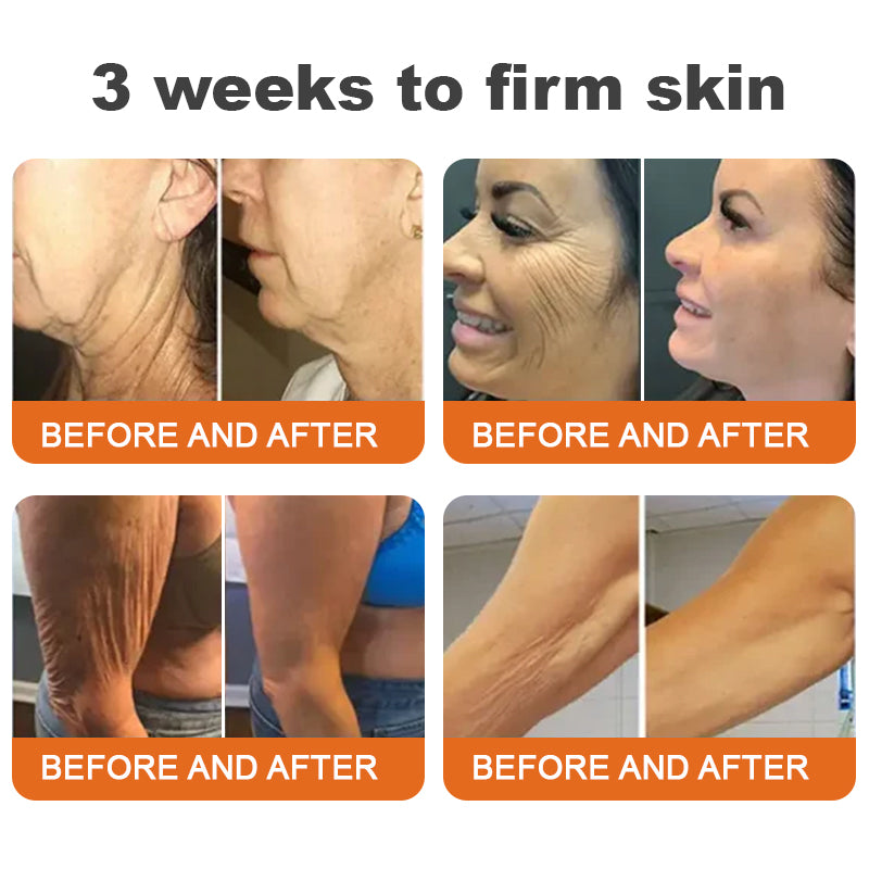 🗽Made and Shipped from USA✨Flysmus™ Botox Bee Venom Firming Serum Stick🔥LAST DAY 50% OFF