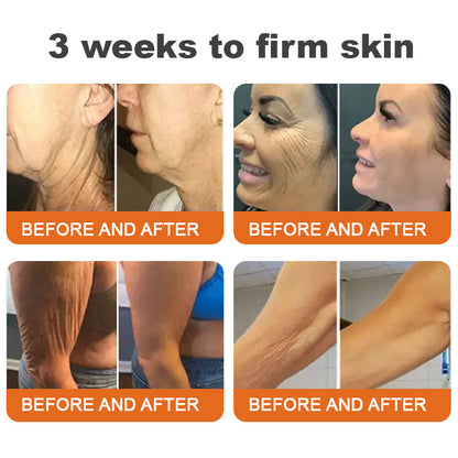 🗽Made and Shipped from USA✨Flysmus™ Botox Bee Venom Firming Serum Stick🔥LAST DAY 50% OFF