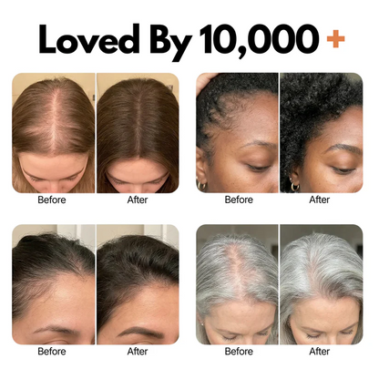🌿 Regrow Your Hair in 4 Weeks: Secret to Thicker, Fuller Hair ✨