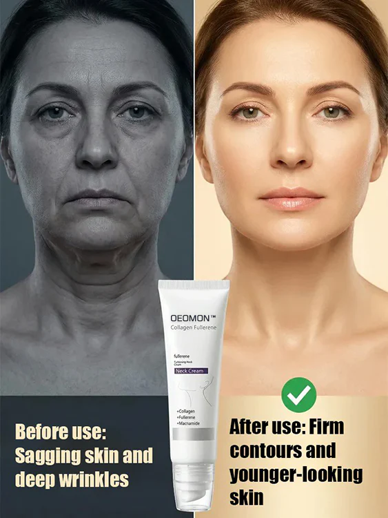 Avasoma® 🏆Flash Sale⚡OEOMON™ Collagen Fullerene Neck Cream – Elevate Your Neck Care Routine ✨