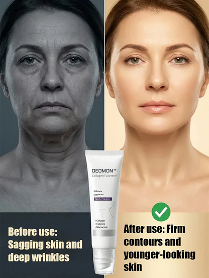 Avasoma® 🏆Flash Sale⚡OEOMON™ Collagen Fullerene Neck Cream – Elevate Your Neck Care Routine ✨