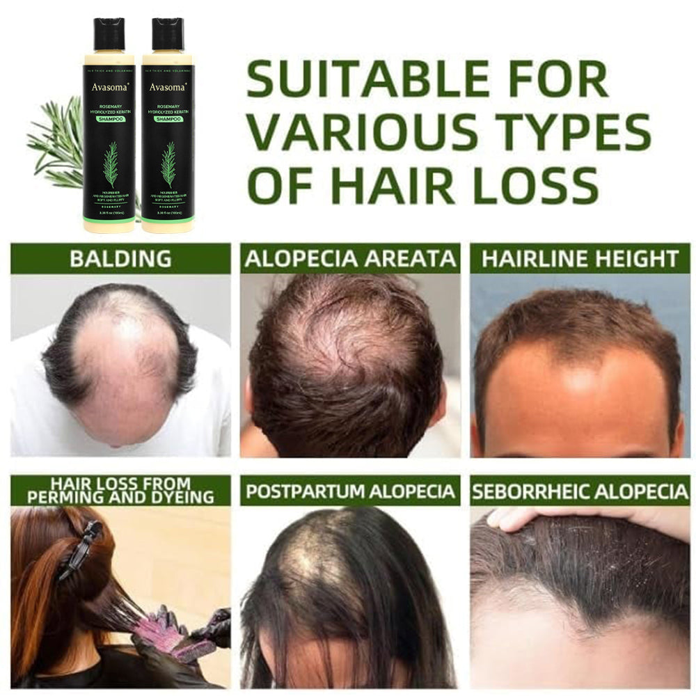 🔥LAST DAY 50% OFF🔥Avasoma® Organic Rosemary Hair Growth Shampoo