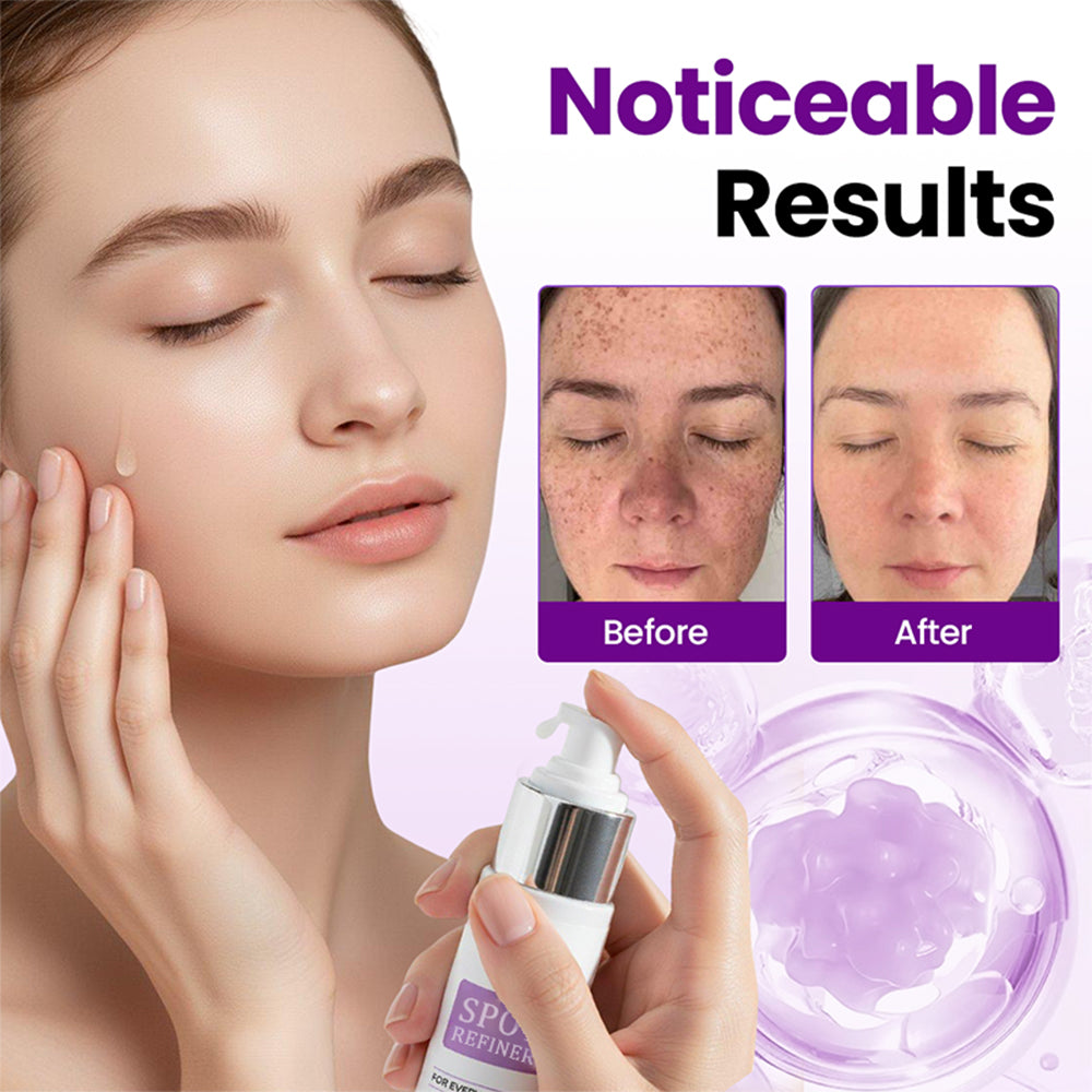 🔥Last day discount🔥Avasoma® SpotRefiner Probiotic Shield Serum