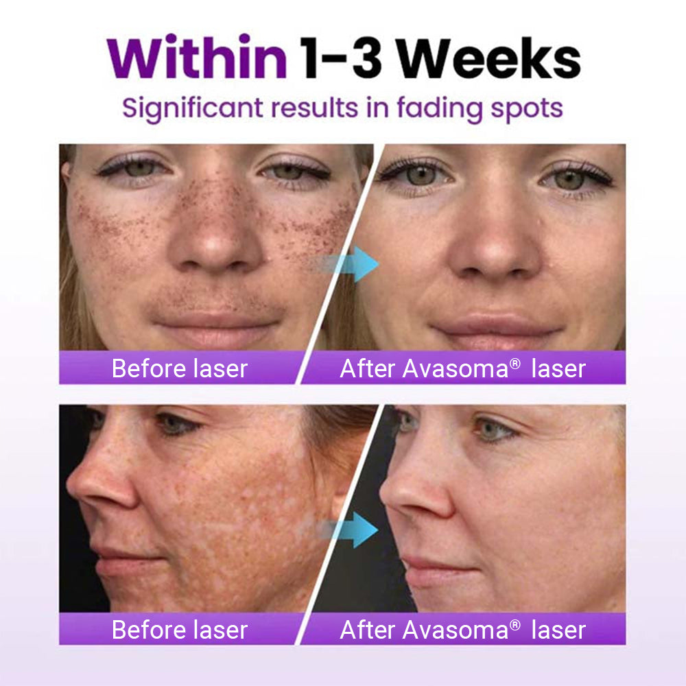 🔥Last day discount🔥Avasoma® SpotRefiner Probiotic Shield Serum