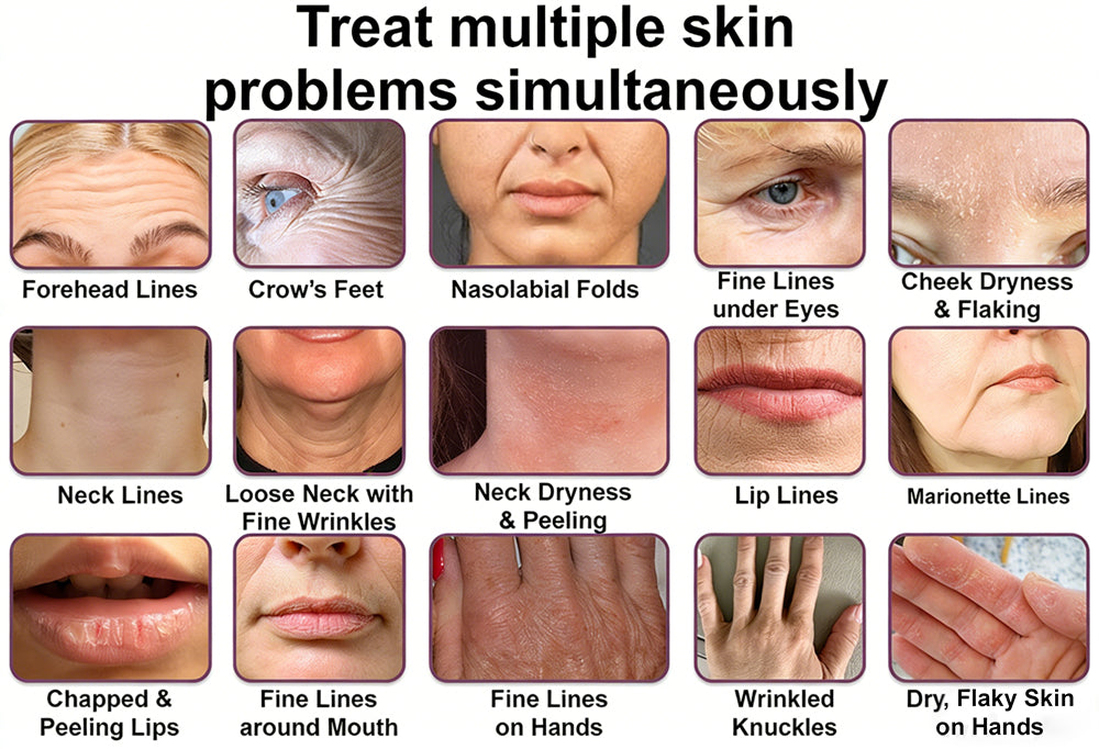 #1 Bestselling🏆--Rolimey® Calcium Multi Balm🗽Anti-Aging & Firming Skincare Stick🔥- Last Day Promotion 50% OFF