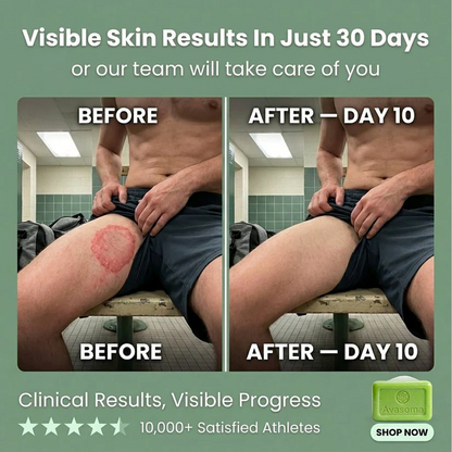🦵Avasoma® Multi-Purpose Antifungal Bar: One Solution for Feet, Body & Persistent Itch