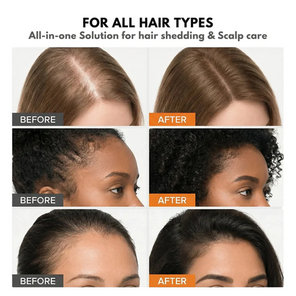 🌿 Regrow Your Hair in 4 Weeks: Secret to Thicker, Fuller Hair ✨
