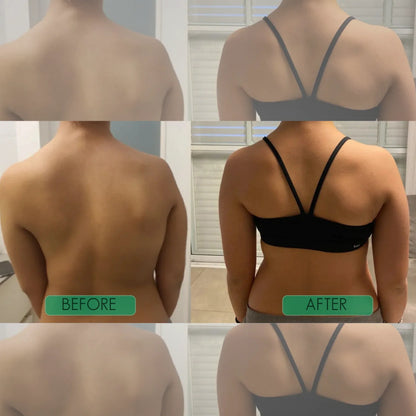 🧍‍♂️Avasoma® |🗽Professional Posture Corrector.Discreetly invisible under clothes for lasting spinal health. Start standing better!