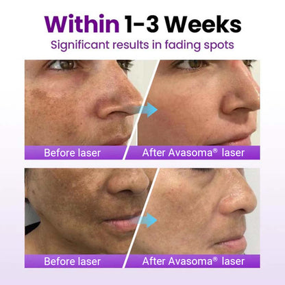 🔥Last day discount🔥Avasoma® SpotRefiner Probiotic Shield Serum