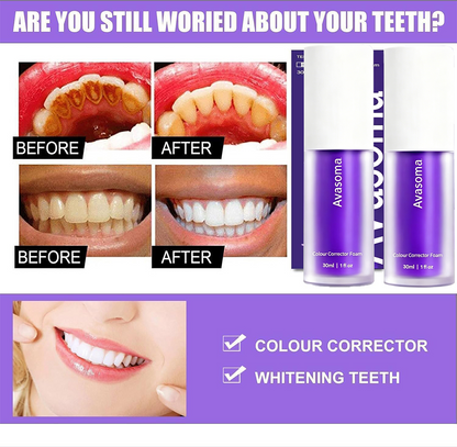🦷Avasoma® Teeth V34 Color Corrector Serum | 30s Yellow Neutralizer & Zero Sensitivity Care