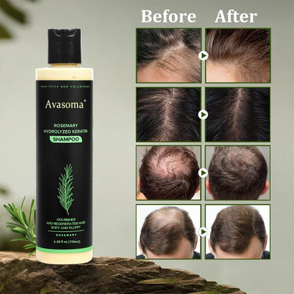 🔥LAST DAY 50% OFF🔥Avasoma® Organic Rosemary Hair Growth Shampoo