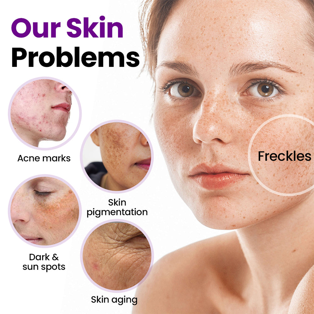 🔥Last day discount🔥Avasoma® SpotRefiner Probiotic Shield Serum