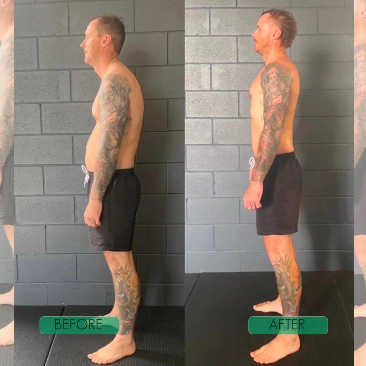🧍‍♂️Avasoma® |🗽Professional Posture Corrector.Discreetly invisible under clothes for lasting spinal health. Start standing better!