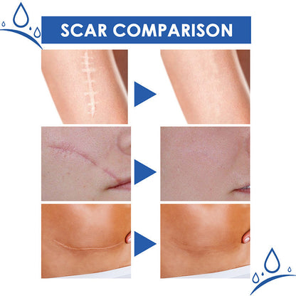 Avasoma® Scar Repair Cream for Men and Women, fade scars and tighten skin in one step
