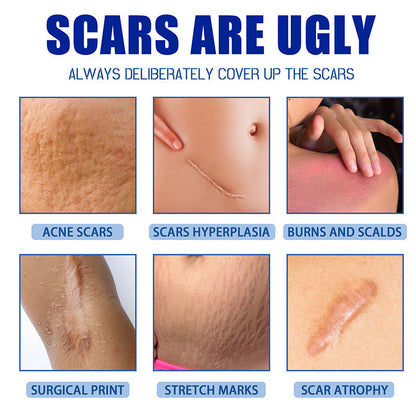 Avasoma® Scar Repair Cream for Men and Women, fade scars and tighten skin in one step