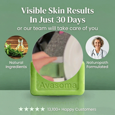 🦵Avasoma® Multi-Purpose Antifungal Bar: One Solution for Feet, Body & Persistent Itch