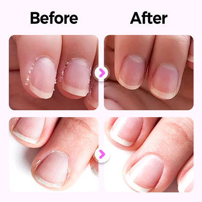 💜BUY 1 GET 1 FREE💜Repairing Nail Damage✨ "Fragrance + manicure + armor" in ONE portable nail care pen💅